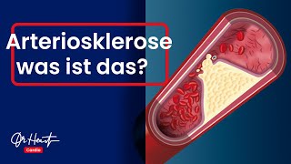 Arteriosklerose  Die bedeutendste Erkrankung überhaupt  Dr Heart [upl. by Esile]