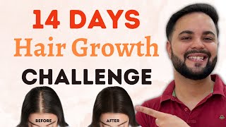 14 Days Extreme Hair Growth Challenge Thicker amp Longer Hair in 2 Weeks [upl. by Eylrahc222]