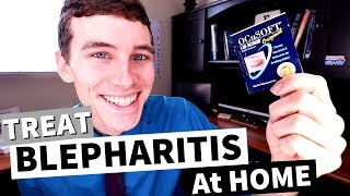 What is Blepharitis How to Treat Blepharitis at Home [upl. by Erving907]