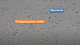 Bacteria and Fungus Microscopy at Various magnifications 400X 800X and 1600X [upl. by Magavern]