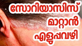 Psoriasis Treatment in Ayurveda Malayalam  Psoriasis Treatment at Home in Malayalam [upl. by Schaeffer]