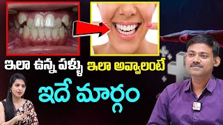 The Perfect Oral Health Care Routine 3 easy steps  La Clinique Dental Surgeon Dr Raviteja [upl. by Akvir487]