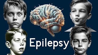 Epilepsy in Children  Simply Explained [upl. by Ezalb]