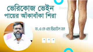 পায়ের আঁকাবাঁকা শিরা রোগের চিকিৎসা  ভেরিকোজ ভেইন  Varicose Veins Treatment  Bangla Health Tips [upl. by Atilef]