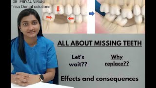 All About Consequences of Missing Tooth [upl. by Reinert684]