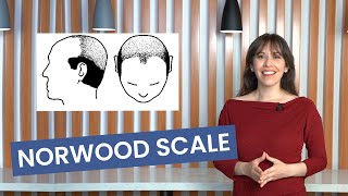 What Is the Norwood Scale How to Understand the Different Stages of Balding  Lordhair [upl. by Homere856]