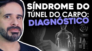 SÍNDROME DO TÚNEL DO CARPO APRENDA DE MANEIRA DESCOMPLICADA [upl. by Sirk]