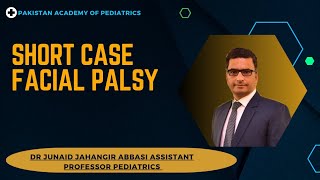 Short Case Facial Palsy [upl. by Martinic37]