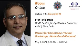 iFocus Online Session 98 Glaucoma 2 Gonioscopy [upl. by Kcinemod]