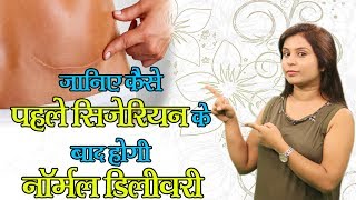 जानिए कैसे पहले सिजेरियन के बाद भी हो सकती है नार्मल डिलीवरी Facts About Cesarean Delivery Health [upl. by Manthei]