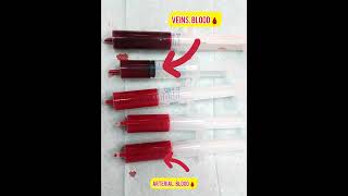 Difference between arterial blood amp veins blood  blood sample collection [upl. by Anaid485]