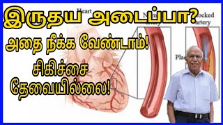 இருதய அடைப்பா அதுக்கு சிகிச்சை வேண்டாம்heart blockageheart failureLifestyle Tamil [upl. by Tenenbaum]