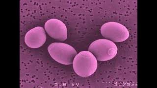 Saccharomyces Boulardii Helps With Diarrhea Irritable Bowel Syndrome Crohns Disease [upl. by Bhatt]