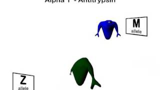 Alpha 1 Antitrypsin Deficiency [upl. by Lad]