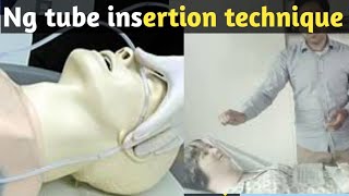 ng tube insertion procedure in hindi step by step Full Explain [upl. by Odnarb121]