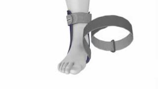 Bauerfeind MalleoLoc® Ankle Brace [upl. by Astraea]