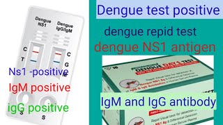 Dengue test positive Ns1 antigen positiveigMigG dengue rapid test positive [upl. by Giddings]