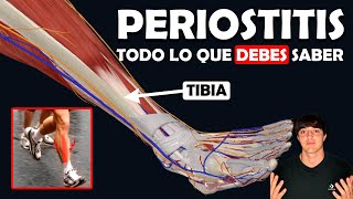 PERIOSTITIS TIBIAL Su TRATAMIENTO y lo que debes saber [upl. by Nodnyl596]