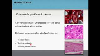 Reparo tecidual  Patologia geral 15 [upl. by Aynad914]