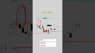 Scalped for 5 points [upl. by Ier]