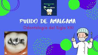 Pulido de amalgama dental [upl. by Dulcine]