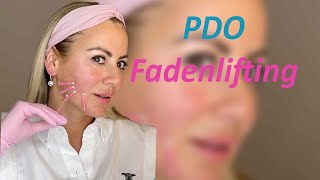 PDO FADENLIFTING Selbsttest [upl. by Perrine]