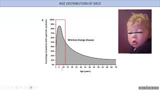 20241009 CHEO Pediatric Grand Rounds [upl. by Annas]