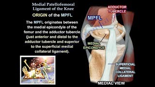 Medial Patellofemoral Ligament Of The Knee Anatomy Everything You Need To Know  Dr Nabil Ebraheim [upl. by Ronaele]