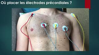 Réalisation dun ECG et bon positionnement des électrodesles chats noirs du 3SM [upl. by Matthia]