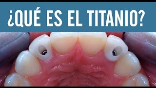 Qué es el titanio  Juan Fernando Salgado  Los implantes dentales [upl. by Halfdan]