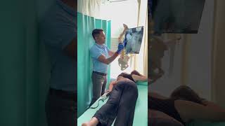 Most challenging scoliosis case treatment by DrRavi scoliosis chiropractic spine shorts reels [upl. by Holey]