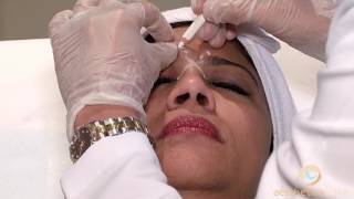 Botulinum Toxin Injections Short introductory tutorial [upl. by Putnam]