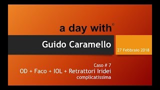 27 feb 2018 ADW Guido Caramello  caso7 [upl. by Oira]