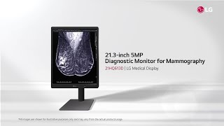 LG Medical Display  21HQ613D 213quot 5MP Diagnostic Monitor for Mammography [upl. by Agnew291]