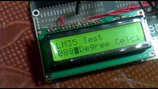 Interfacing LM35 Temperature Sensor with PIC18F4520 Microcontroller [upl. by Klarika]