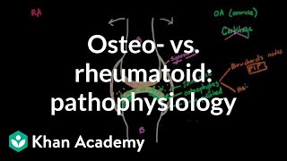 Osteoarthritis vs rheumatoid arthritis pathophysiology  NCLEXRN  Khan Academy [upl. by Kcirdlek11]