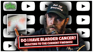 Do I Have Bladder Cancer Reacting To The Current Findings What Am I Going To Do About It [upl. by Lanuk]