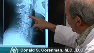 How to Read Xrays of the Cervical Spine Neck  Colorado Spine Expert [upl. by Sudnak]