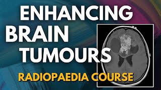 Enhancing brain tumours learning pathway  New Course [upl. by Ilime]