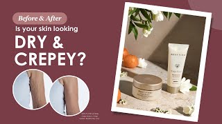 Rejuvenate Dry and Crepey Skin with Crepe Erase® [upl. by Ruder839]