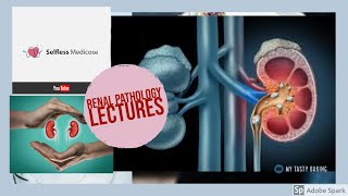 RENAL PATHOLOGY lecture 22 UROLITHIASIS made easy [upl. by Giffer567]