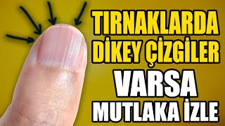 Tırnaklarda Çizgiler Oluşmasının Nedeni ve Evde Nasıl Tadavi Edilir  Tırnak Sağlığı İçin Bunu Yap [upl. by Fisch]