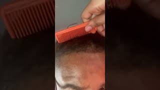 Combing out dandruff out husband dreads ASMRasmrvideo dandruff dandruffremoval [upl. by Akanke]