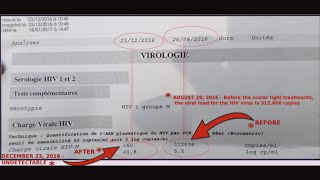 HIV Positive for 25 Years then HIV is GONE  PCR Test Result [upl. by Ardnasak]