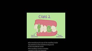 malocclusions of teethclassification of occlusionclass1class2class 3dentalbasicshorts teeth [upl. by Suivat]