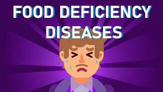 What is Starvation and Malnutrition What are Food Deficiency Diseases [upl. by Ysdnil]