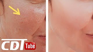 7 astuces naturels pour resserrer les pores dilatés et avoir une peau radieuse  CDT NEWS [upl. by Yrojram577]