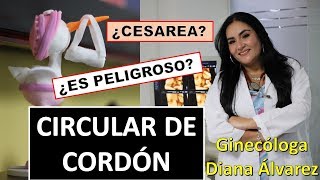 CIRCULAR DE CORDON POR GINECOLOGA DIANA ALVAREZ [upl. by Emili900]