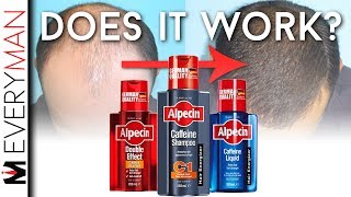 DOES CAFFEINE SHAMPOO WORK  Alpecin REVIEW amp Hair Growth Alternatives [upl. by Rayburn]