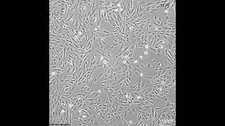 How quick do these melanoma cells grow [upl. by Reese]